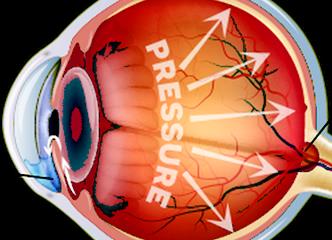Eye Pressure / Intraocular pressure (IOP)
