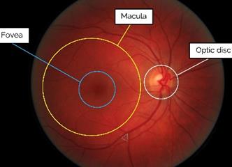 Retinal Exam - Fundoscopy